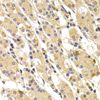 TNNI3 / Cardiac Troponin I Antibody - Immunohistochemistry of paraffin-embedded human stomach tissue.
