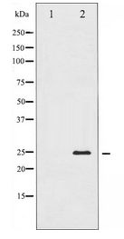 TNNI3 / Cardiac Troponin I Antibody - Western blot of TNNI3 expression in Jurkat whole cell lysates,The lane on the left is treated with the antigen-specific peptide.