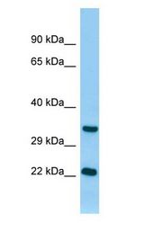 TNNI3 / Cardiac Troponin I Antibody - TNNI3 / CTnI antibody Western Blot of Rat Pancreas.  This image was taken for the unconjugated form of this product. Other forms have not been tested.
