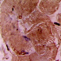 TNNI3 / Cardiac Troponin I Antibody - Immunohistochemical analysis of cTnI staining in human heart formalin fixed paraffin embedded tissue section. The section was pre-treated using heat mediated antigen retrieval with sodium citrate buffer (pH 6.0). The section was then incubated with the antibody at room temperature and detected using an HRP-conjugated compact polymer system. DAB was used as the chromogen. The section was then counterstained with hematoxylin and mounted with DPX.