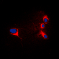 TNNI3 / Cardiac Troponin I Antibody - Immunofluorescent analysis of cTnI staining in HepG2 cells. Formalin-fixed cells were permeabilized with 0.1% Triton X-100 in TBS for 5-10 minutes and blocked with 3% BSA-PBS for 30 minutes at room temperature. Cells were probed with the primary antibody in 3% BSA-PBS and incubated overnight at 4 deg C in a humidified chamber. Cells were washed with PBST and incubated with a DyLight 594-conjugated secondary antibody (red) in PBS at room temperature in the dark. DAPI was used to stain the cell nuclei (blue).