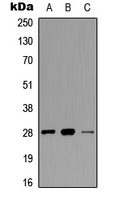 TNNI3 / Cardiac Troponin I Antibody - Western blot analysis of cTnI (pS22/S23) expression in SHSY5Y (A); NIH3T3 (B); mouse heart (C) whole cell lysates.