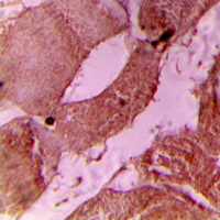 TNNI3 / Cardiac Troponin I Antibody - Immunohistochemical analysis of cTnI (pS22/S23) staining in human heart formalin fixed paraffin embedded tissue section. The section was pre-treated using heat mediated antigen retrieval with sodium citrate buffer (pH 6.0). The section was then incubated with the antibody at room temperature and detected using an HRP conjugated compact polymer system. DAB was used as the chromogen. The section was then counterstained with hematoxylin and mounted with DPX.