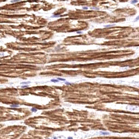 TNNI3 / Cardiac Troponin I Antibody - Immunohistochemical analysis of cTnI (pS43) staining in human heart formalin fixed paraffin embedded tissue section. The section was pre-treated using heat mediated antigen retrieval with sodium citrate buffer (pH 6.0). The section was then incubated with the antibody at room temperature and detected using an HRP conjugated compact polymer system. DAB was used as the chromogen. The section was then counterstained with hematoxylin and mounted with DPX.