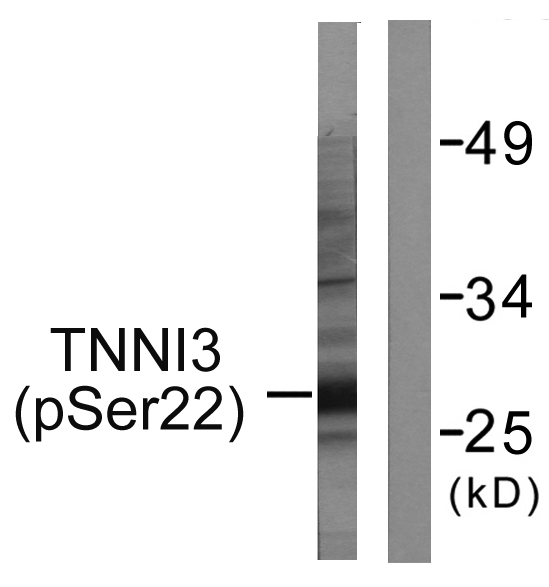 TNNI3 / Cardiac Troponin I Antibody - Western blot analysis of lysates from mouse heart, using TNNI3 (Phospho-Ser22+Ser23) Antibody. The lane on the right is blocked with the phospho peptide.