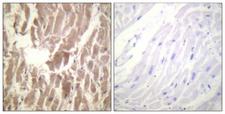 TNNI3 / Cardiac Troponin I Antibody - Immunohistochemistry analysis of paraffin-embedded human heart, using TNNI3 (Phospho-Ser43) Antibody. The picture on the right is blocked with the phospho peptide.