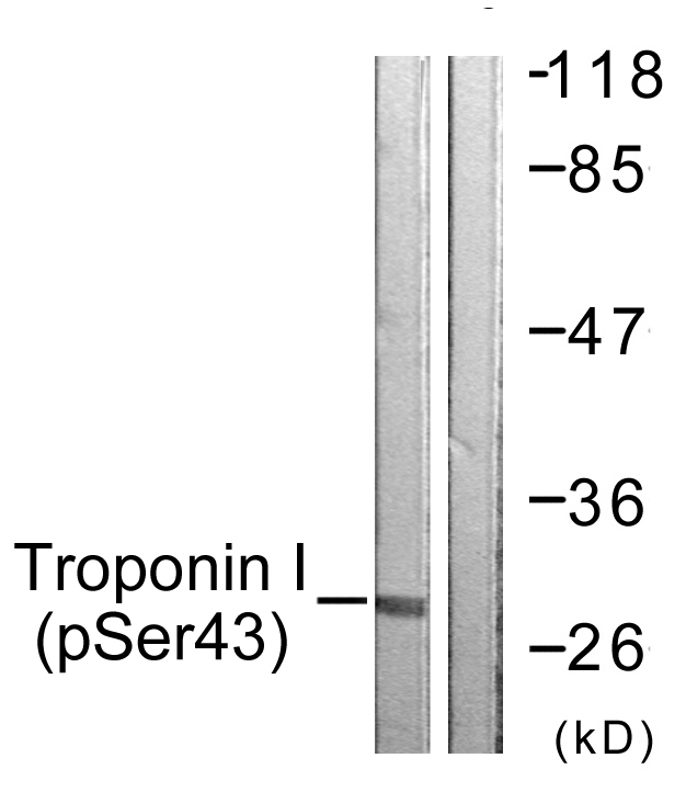 TNNI3 / Cardiac Troponin I Antibody - Western blot analysis of lysates from Jurkat cells, using TNNI3 (Phospho-Ser43) Antibody. The lane on the right is blocked with the phospho peptide.