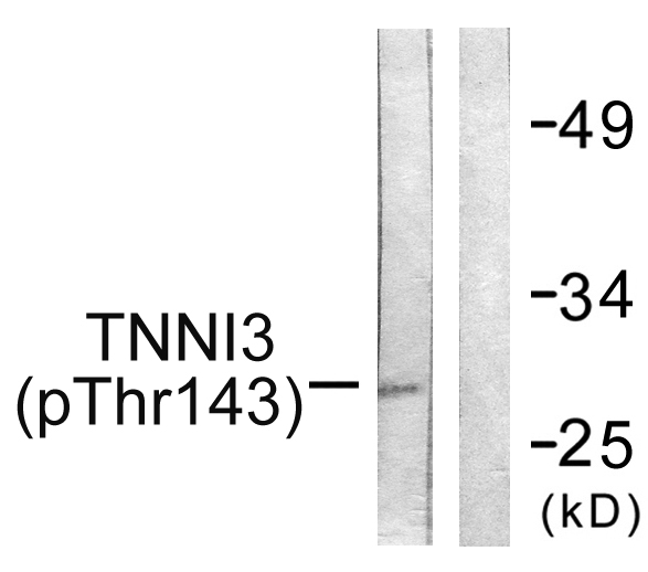 TNNI3 / Cardiac Troponin I Antibody - Western blot analysis of lysates from mouse heart, using TNNI3 (Phospho-Thr142) Antibody. The lane on the right is blocked with the phospho peptide.