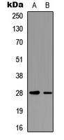 TNNI3 / Cardiac Troponin I Antibody - Western blot analysis of cTnI (pT142) expression in HEK293T (A); mouse heart (B) whole cell lysates.