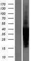 TNNI3 / Cardiac Troponin I Protein - Western validation with an anti-DDK antibody * L: Control HEK293 lysate R: Over-expression lysate