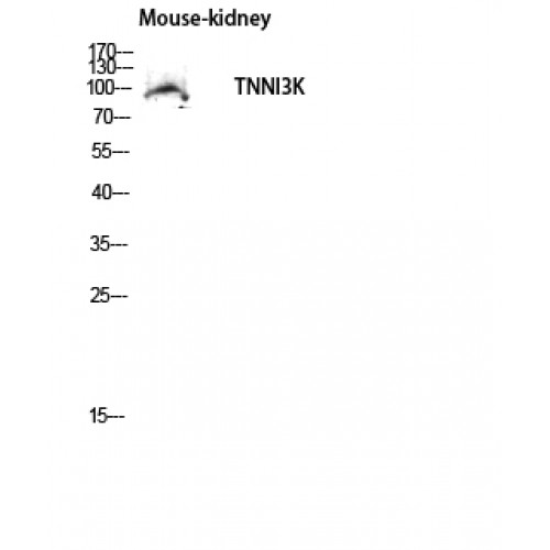 TNNI3K / CARK Antibody - Western blot of TNNI3K antibody