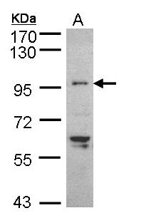 TNNI3K / CARK Antibody - Sample (30 ug of whole cell lysate). A: HeLaS3. 7.5% SDS PAGE. TNNI3K / CARK antibody diluted at 1:5000
