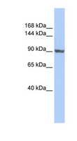 TNNI3K / CARK Antibody - TNNI3K antibody Western blot of HepG2 cell lysate. This image was taken for the unconjugated form of this product. Other forms have not been tested.