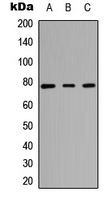 TNNI3K / CARK Antibody - Western blot analysis of CARK expression in HEK293T (A); Raw264.7 (B); H9C2 (C) whole cell lysates.