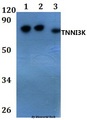 TNNI3K / CARK Antibody - Western blot of TNNI3K antibody at 1:500 dilution. Lane 1: HEK293T whole cell lysate. Lane 2: Raw264.7 whole cell lysate. Lane 3: H9C2 whole cell lysate.