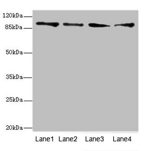 TNNI3K / CARK Antibody - Western blot All Lanes: TNNI3K antibody at 4.77ug/ml Lane 1: Hela whole cell lysate Lane 2: Mouse heart tissue Lane 3: HepG-2 whole cell lysate Lane 4: Jurkat whole cell lysate Secondary Goat polyclonal to Rabbit IgG at 1/10000 dilution Predicted band size: 93,105,78,95 kDa Observed band size: 93 kDa