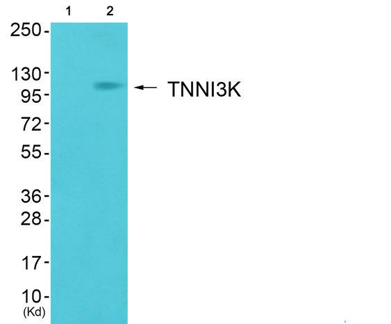 TNNI3K / CARK Antibody - Western blot analysis of extracts from COS7 cells, using TNNI3K antibody.
