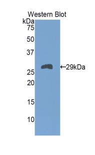 TNNT1 / TNT Antibody - Western blot of recombinant TNNT1 / TNT.  This image was taken for the unconjugated form of this product. Other forms have not been tested.
