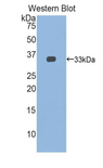 TNNT1 / TNT Antibody - Western blot of recombinant TNNT1 / TNT.  This image was taken for the unconjugated form of this product. Other forms have not been tested.