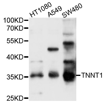 TNNT1 / TNT Antibody - Western blot analysis of extracts of various cell lines, using TNNT1 antibody at 1:1000 dilution. The secondary antibody used was an HRP Goat Anti-Rabbit IgG (H+L) at 1:10000 dilution. Lysates were loaded 25ug per lane and 3% nonfat dry milk in TBST was used for blocking. An ECL Kit was used for detection and the exposure time was 15s.