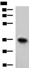 TNNT1 / TNT Antibody - Western blot analysis of Mouse skeletal muscle tissue lysate  using TNNT1 Polyclonal Antibody at dilution of 1:550
