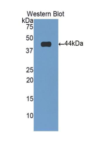 TNNT2 / CTNT Antibody - Western blot of recombinant TNNT2 / CTNT.  This image was taken for the unconjugated form of this product. Other forms have not been tested.