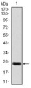 TNNT2 / CTNT Antibody - Western blot using troponin T2 monoclonal antibody against human troponin T2 (AA: 88-249) recombinant protein. (Expected MW is 25.1 kDa)