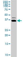 TNNT2 / CTNT Antibody - TNNT2 monoclonal antibody (M02), clone 3H4-F7 Western blot of TNNT2 expression in COLO 320 HSR.