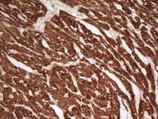 TNNT2 / CTNT Antibody - Immunohistochemical staining of paraffin-embedded Human adult heart tissue using anti-TNNT2 mouse monoclonal antibody. (Heat-induced epitope retrieval by 1 mM EDTA in 10mM Tris, pH8.5, 120C for 3min,