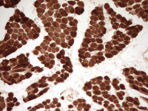 TNNT2 / CTNT Antibody - Immunohistochemical staining of paraffin-embedded Human muscle tissue using anti-TNNT2 mouse monoclonal antibody. (Heat-induced epitope retrieval by 1 mM EDTA in 10mM Tris, pH8.5, 120C for 3min,