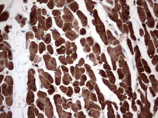 TNNT2 / CTNT Antibody - IHC of paraffin-embedded Human adult heart tissue using anti-TNNT2 mouse monoclonal antibody. (Heat-induced epitope retrieval by 1 mM EDTA in 10mM Tris, pH8.5, 120°C for 3min).