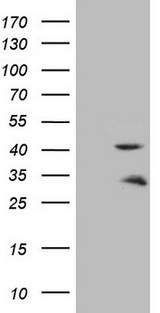 TNNT2 / CTNT Antibody - HEK293T cells were transfected with the pCMV6-ENTRY control. (Left lane) or pCMV6-ENTRY TNNT2. (Right lane) cDNA for 48 hrs and lysed. Equivalent amounts of cell lysates. (5 ug per lane) were separated by SDS-PAGE and immunoblotted with anti-TNNT2.