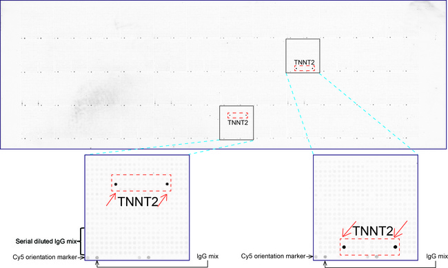 TNNT2 / CTNT Antibody - OriGene overexpression protein microarray chip was immunostained with UltraMAB anti-TNNT2 mouse monoclonal antibody. The positive reactive proteins are highlighted with two red arrows in the enlarged subarray. All the positive controls spotted in this subarray are also labeled for clarification. (1:100)