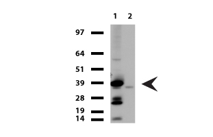 TNNT2 / CTNT Antibody - Western blot of human tissue lysates. (15ug) from 2 different tissues. (1: Heart, 2: Muscle). Diluation: 1:500.