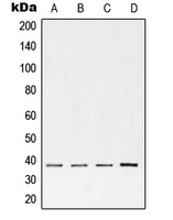 TNNT2 / CTNT Antibody - Western blot analysis of cTnT expression in H9 (A); 4T1 (B); human heart (C) whole cell lysates.