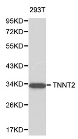 TNNT2 / CTNT Antibody - Western blot of TNNT2 pAb in extracts from 293T cells.