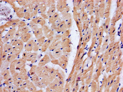 TNNT2 / CTNT Antibody - IHC image of TNNT2 Antibody diluted at 1:200 and staining in paraffin-embedded human heart tissue performed on a Leica BondTM system. After dewaxing and hydration, antigen retrieval was mediated by high pressure in a citrate buffer (pH 6.0). Section was blocked with 10% normal goat serum 30min at RT. Then primary antibody (1% BSA) was incubated at 4°C overnight. The primary is detected by a biotinylated secondary antibody and visualized using an HRP conjugated SP system.