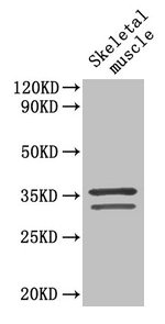 TNNT2 / CTNT Antibody - Western Blot Positive WB detected in: Mouse skeletal muscle All lanes: TNNT2 antibody at 4µg/ml Secondary Goat polyclonal to rabbit IgG at 1/50000 dilution Predicted band size: 36, 32, 35, 34, 31 kDa Observed band size: 32, 36 kDa