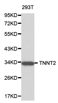 TNNT2 / CTNT Antibody - Western blot analysis of 293T cell lysate.