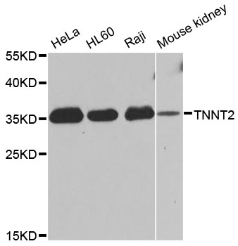 TNNT2 / CTNT Antibody - Western blot analysis of extracts of various cell lines, using TNNT2 antibody at 1:1000 dilution. The secondary antibody used was an HRP Goat Anti-Rabbit IgG (H+L) at 1:10000 dilution. Lysates were loaded 25ug per lane and 3% nonfat dry milk in TBST was used for blocking. An ECL Kit was used for detection and the exposure time was 30s.