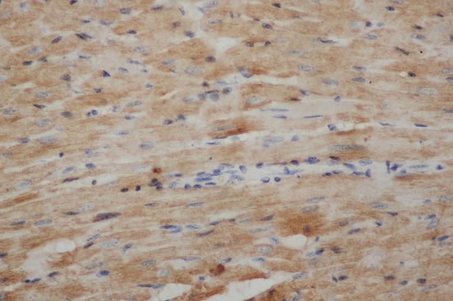 TNNT2 / CTNT Antibody - Immunohistochemistry of paraffin-embedded Mouse heart using TNNT2 Polyclonal Antibody at dilution of 1:50.