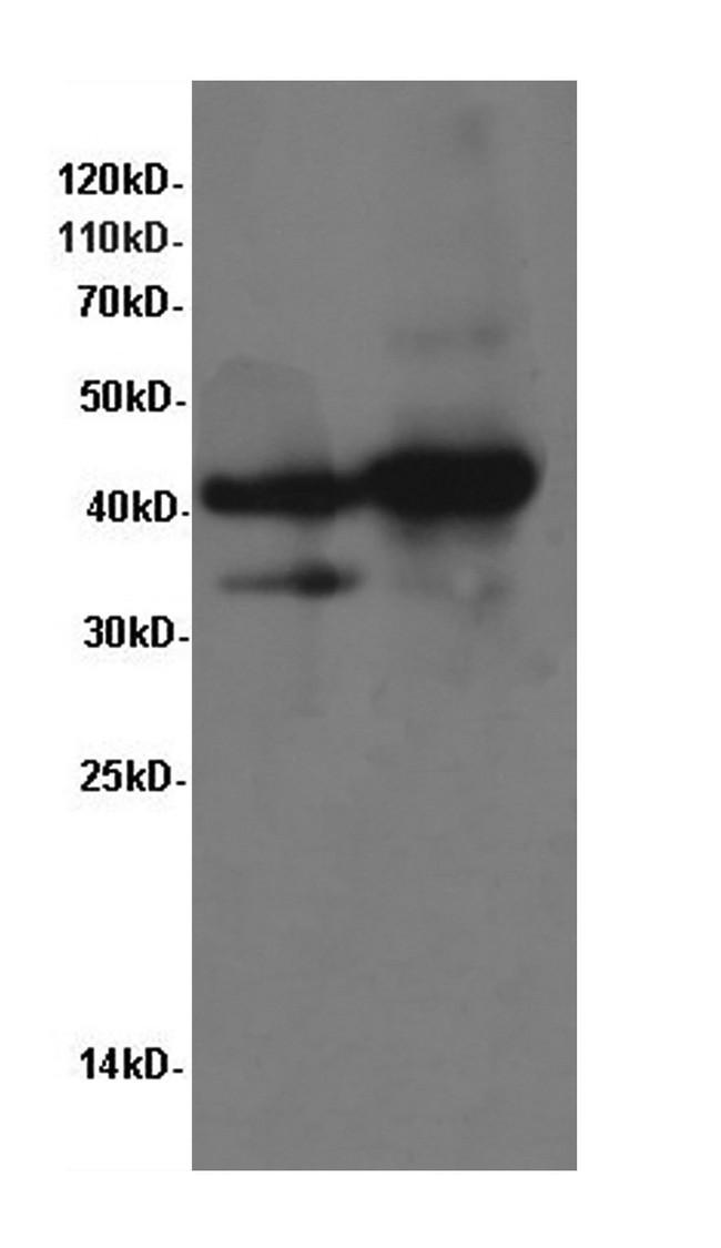TNNT2 / CTNT Antibody - Western Blot analysis of Rat heart and Mouse heart using TNNT2 Polyclonal Antibody at dilution of 1:600.