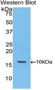 TNNT3 Antibody - Western blot of recombinant TNNT3.  This image was taken for the unconjugated form of this product. Other forms have not been tested.
