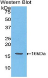 TNNT3 Antibody - Western blot of recombinant TNNT3.  This image was taken for the unconjugated form of this product. Other forms have not been tested.