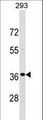 TNNT3 Antibody - TNNT3 Antibody western blot of 293 cell line lysates (35 ug/lane). The TNNT3 antibody detected the TNNT3 protein (arrow).