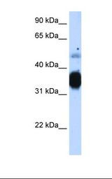 TNNT3 Antibody - Fetal muscle cell lysate. Antibody concentration: 1.25 ug/ml. Gel concentration: 12%.  This image was taken for the unconjugated form of this product. Other forms have not been tested.