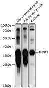 TNNT3 Antibody - Western blot analysis of extracts of various cell lines, using TNNT3 antibody at 1:1000 dilution. The secondary antibody used was an HRP Goat Anti-Rabbit IgG (H+L) at 1:10000 dilution. Lysates were loaded 25ug per lane and 3% nonfat dry milk in TBST was used for blocking. An ECL Kit was used for detection and the exposure time was 10s.