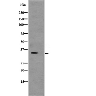 TNNT3 Antibody - Western blot analysis of TNNT3 expression in human skeletal muscle lysate; mouse skeletal muscle lysate; rat skeletal muscle lysate. The lane on the left is treated with the antigen-specific peptide.