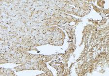 TNNT3 Antibody - 1:100 staining mouse muscle tissue by IHC-P. The sample was formaldehyde fixed and a heat mediated antigen retrieval step in citrate buffer was performed. The sample was then blocked and incubated with the antibody for 1.5 hours at 22°C. An HRP conjugated goat anti-rabbit antibody was used as the secondary.