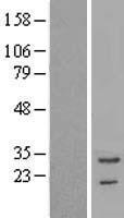 TNNT3 Protein - Western validation with an anti-DDK antibody * L: Control HEK293 lysate R: Over-expression lysate